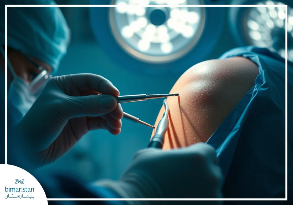 Image Of A Doctor Performing An Arthroscopy On The Shoulder Joint To Perform Surgery On It