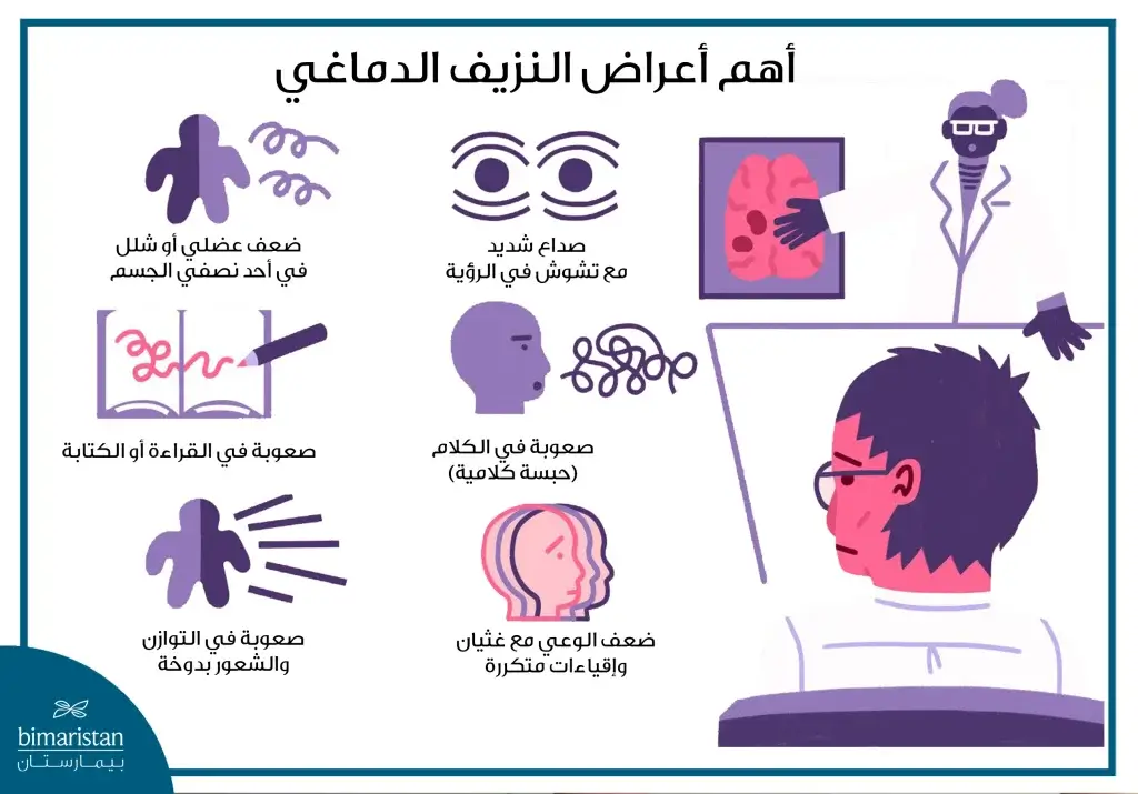 صورة توضح أشيع أعراض نزيف الدماغ عند الكبار