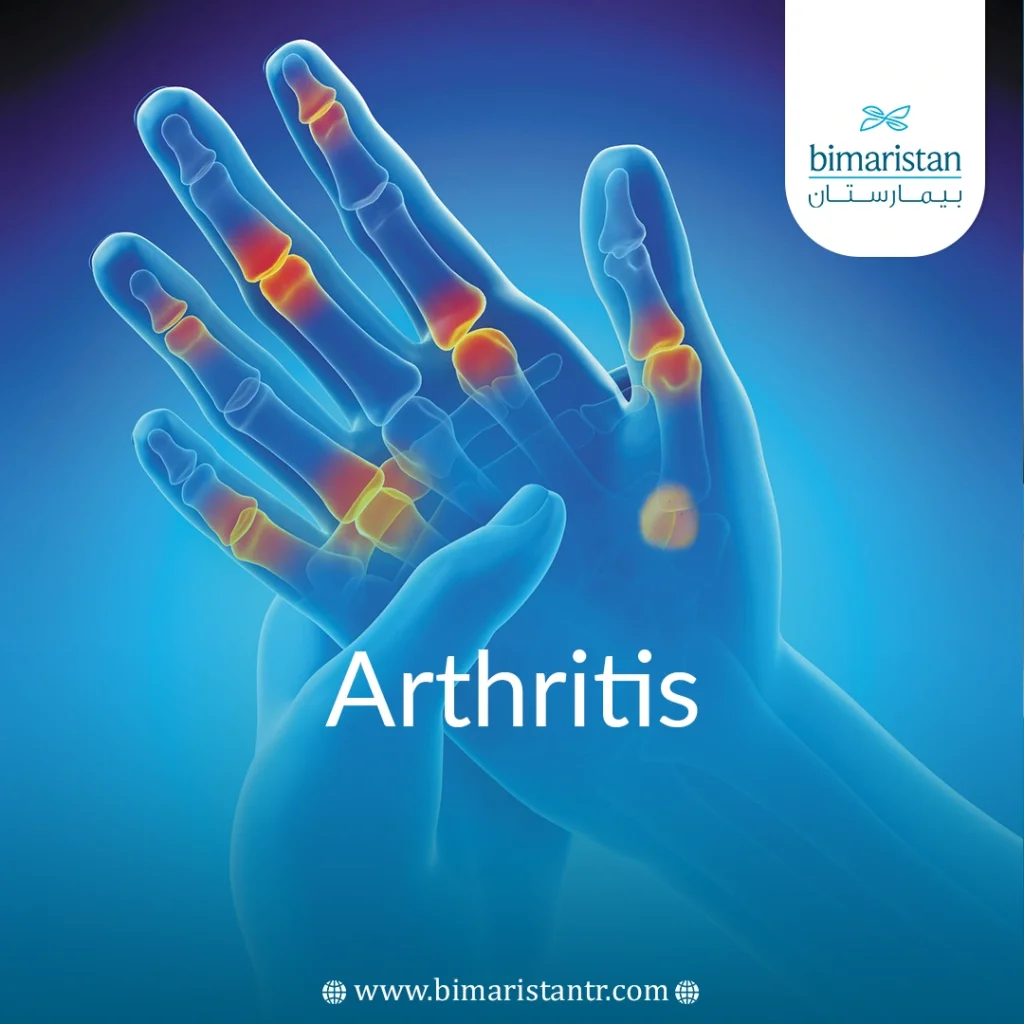 Arthritis