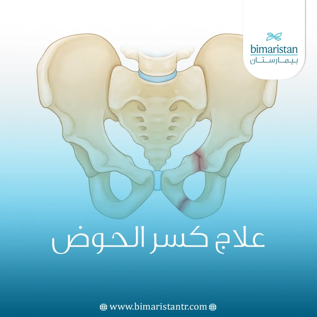 علاج كسر الحوض أفضل 3 طرق علاجية في تركيا