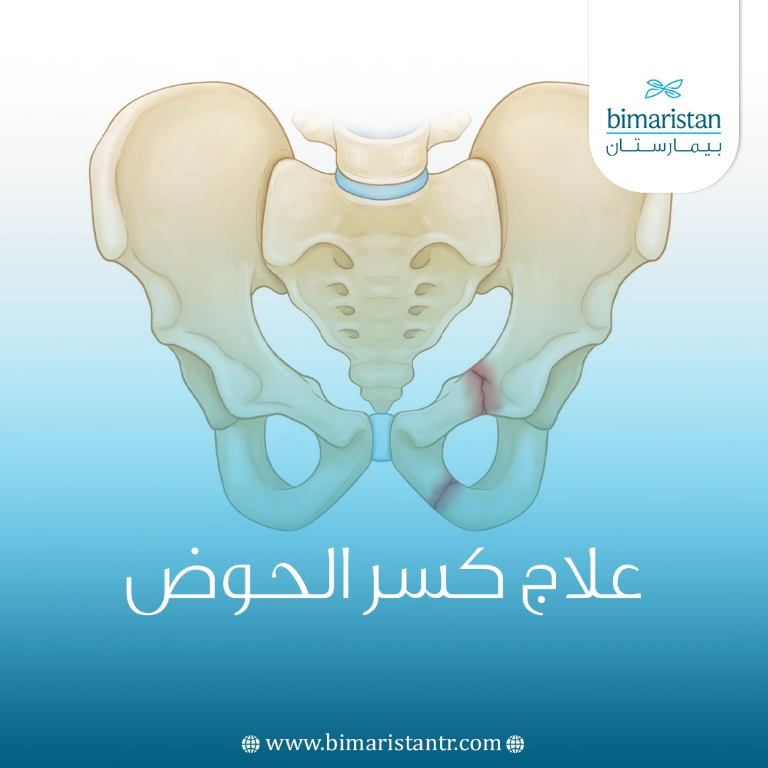 علاج كسر الحوض أفضل 3 طرق علاجية في تركيا