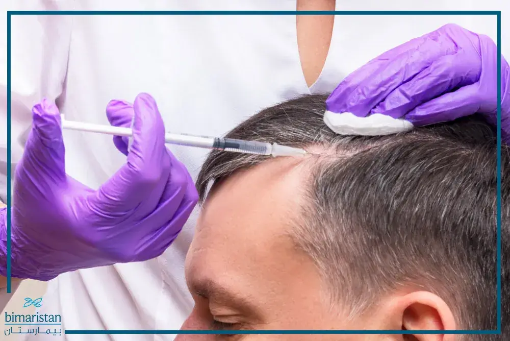 Plasma Injection For Hair After Transplantation