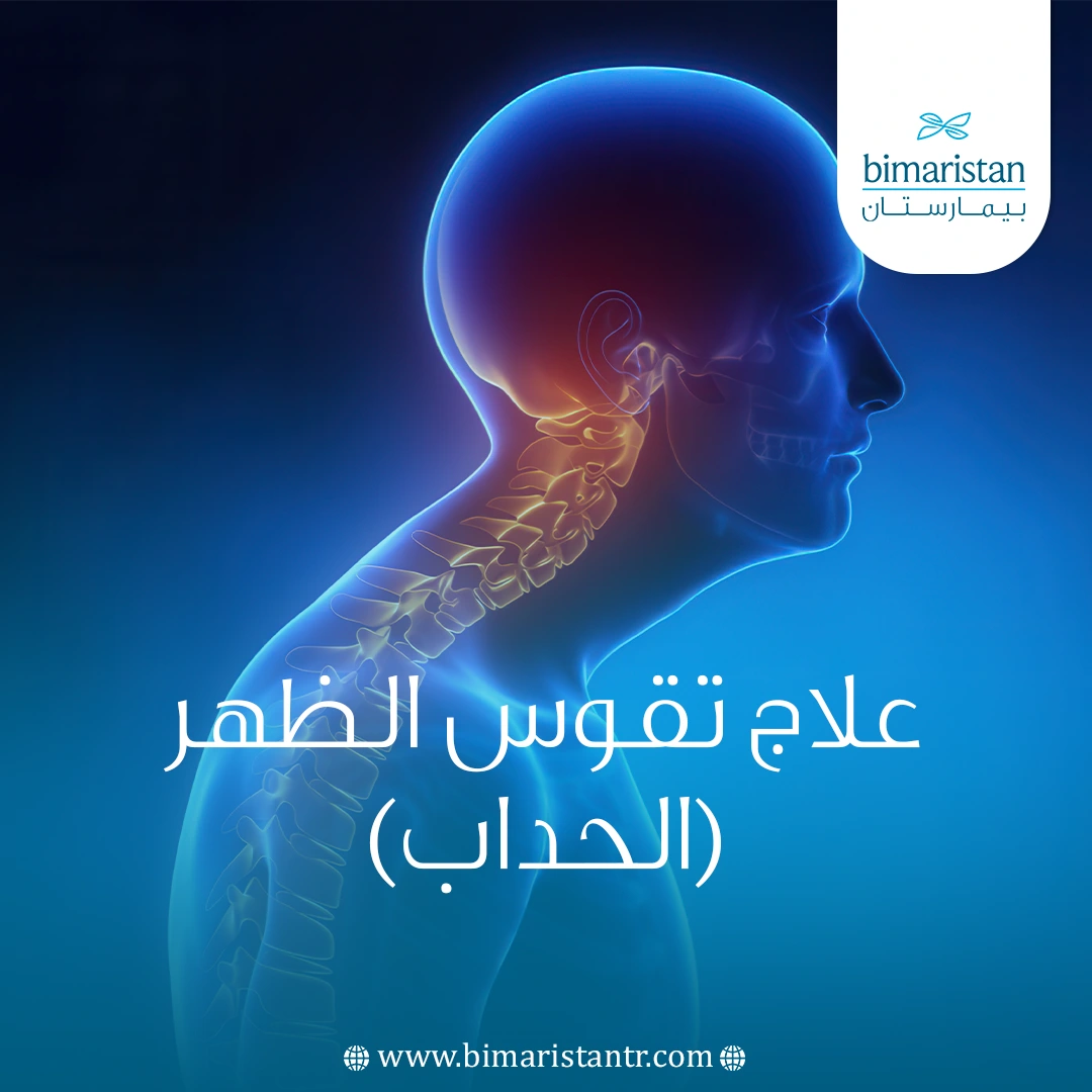 علاج تقوس الظهر (الحداب): حل ثوري لعلاج التقوس - بيمارستان