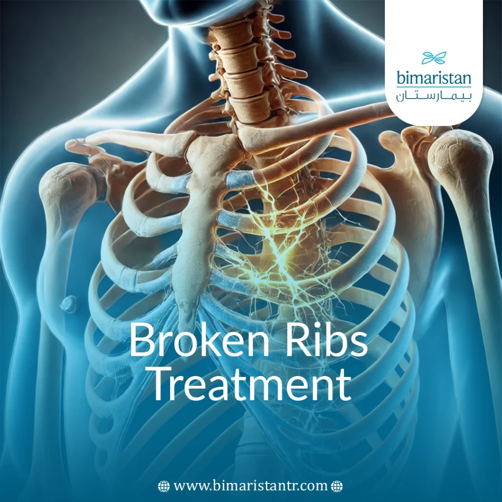 Broken Ribs Treatment In Turkey: Options &Amp; Recovery