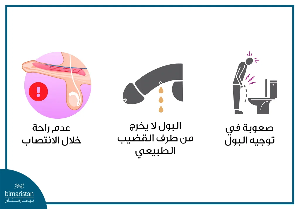 عملية الإحليل السفلي: تعرف على أسباب عملية الإحليل السفلي وأعراضه وطرق علاجه 3 أعراض الإحليل السفلي