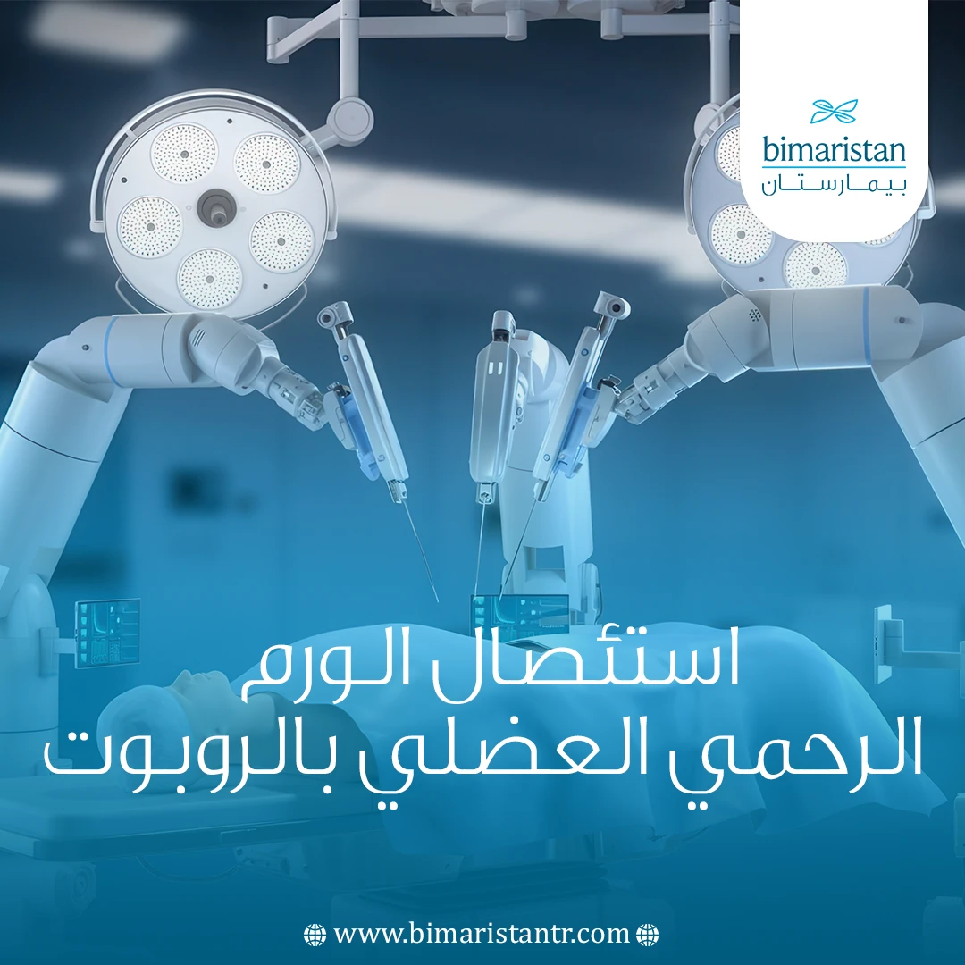 استئصال الورم الرحمي العضلي بالروبوت