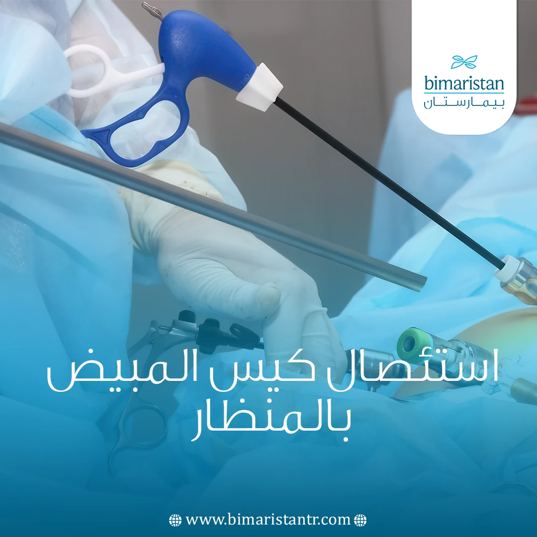 استئصال كيس المبيض بالمنظار