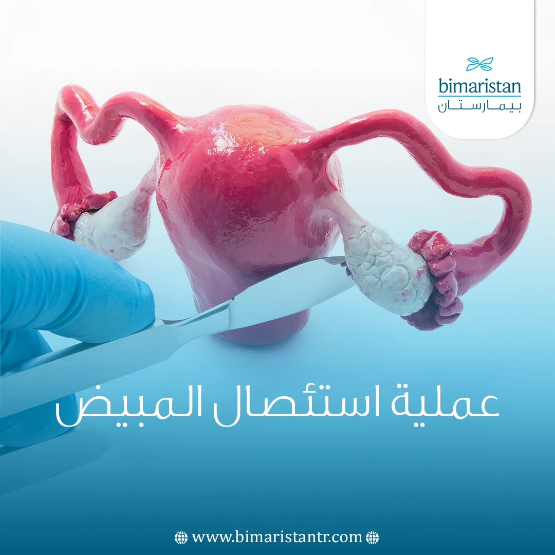 عملية-استئصال-المبيض