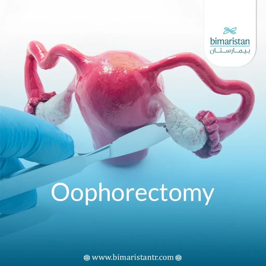Oophorectomy In Turkey: Indications, Alternatives &Amp; Recovery