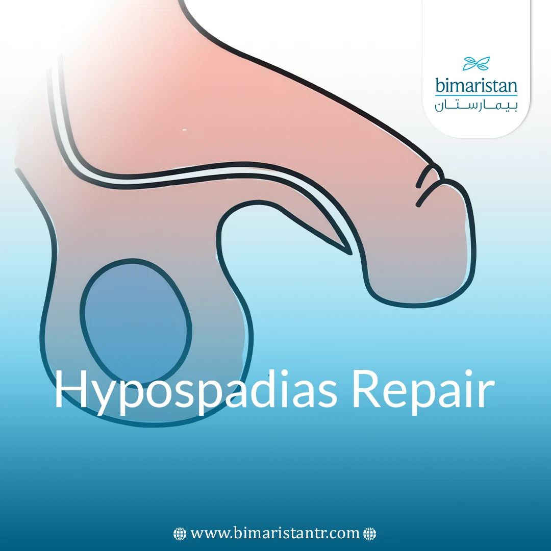 Hypospadias Repair