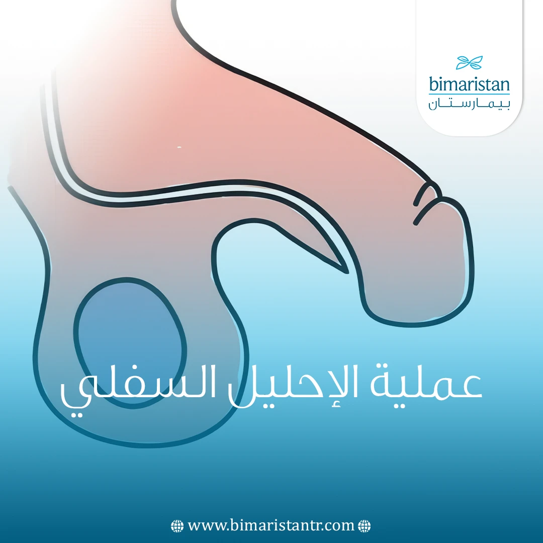 عملية الإحليل السفلي