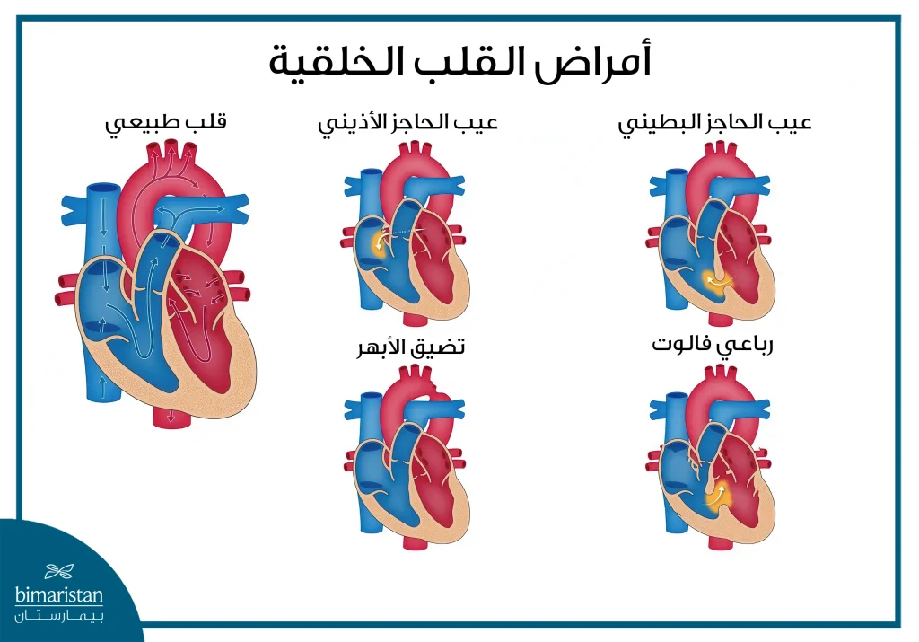 أعراض أمراض القلب عند حديثي الولادة: كيف تكتشفها مبكراً؟ 3 التشوهات القلبية الشائعة عند حديثي الولادة