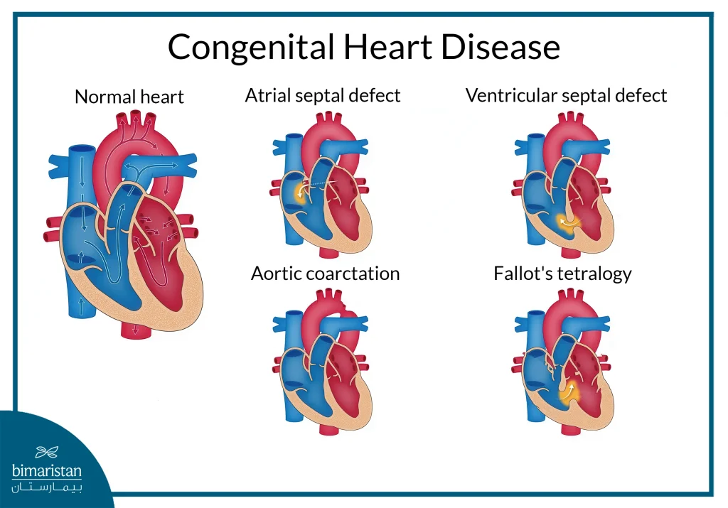 Symptoms Of Heart Disease In Newborns: Early Signs &Amp; Detection Guide 3 Common Cardiac Abnormalities In Newborns