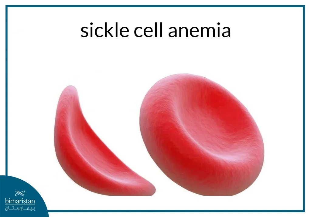 Blood Disorders: The Hidden Danger And Ways To Stay Safe 2 Erythrocyte Shape In Sickle Cell Anemia
