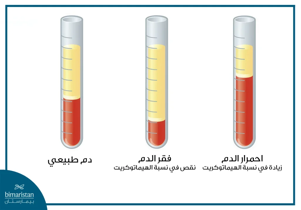 أمراض الدم: الخطر الصامت وكيفية التصدي له 4 اختبار الهيماتوكريت للكشف عن أمراض الدم