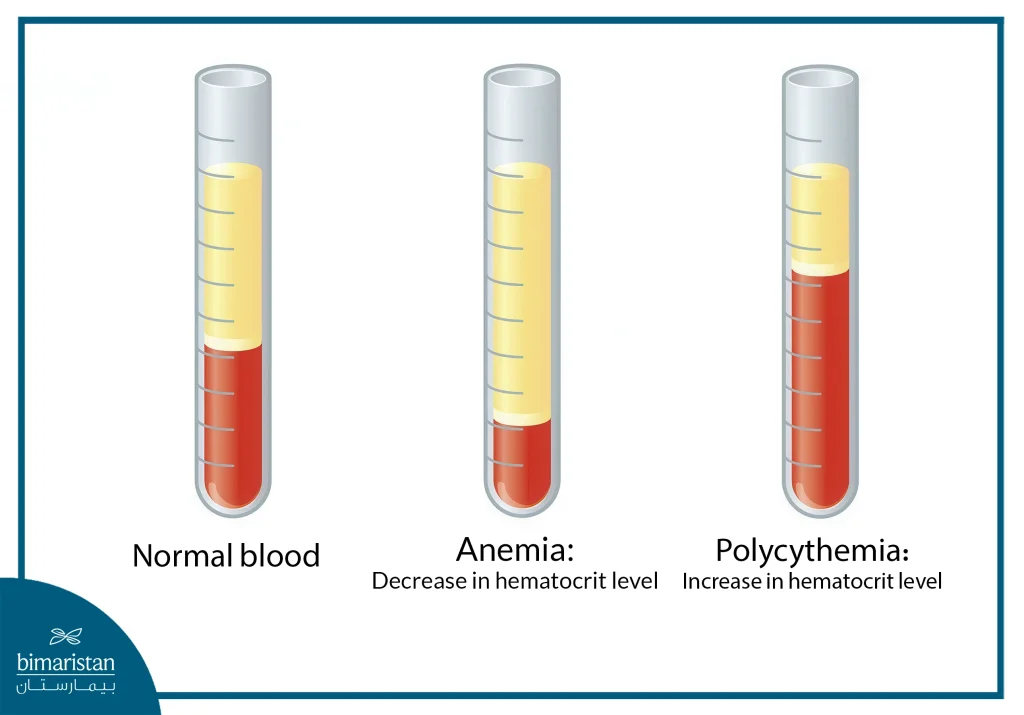 Blood Disorders: The Hidden Danger And Ways To Stay Safe 3 Hematocrit Test For Blood Disorders