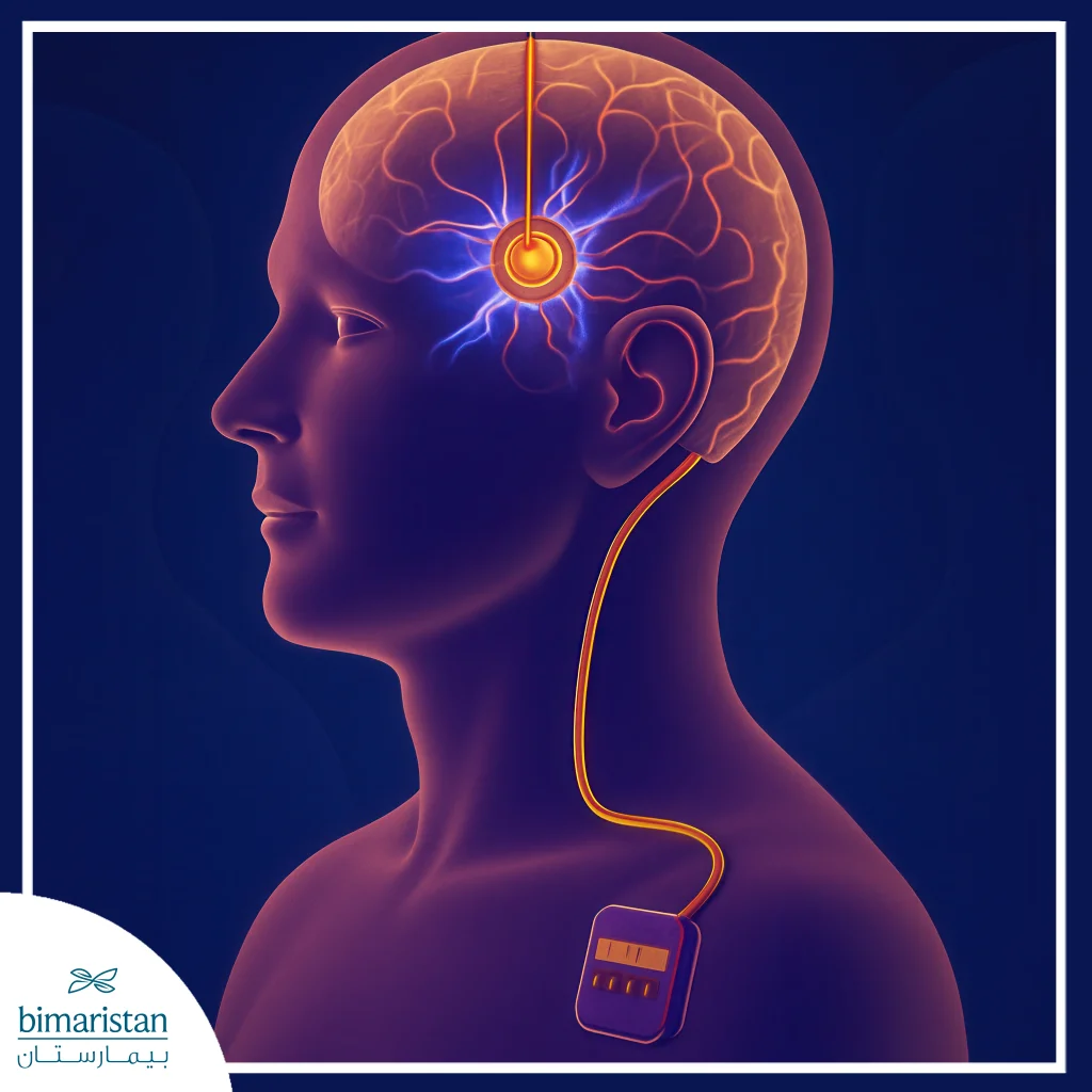 Parkinson’s Disease Rehabilitation: The Secret To Regaining Strength &Amp; Mobility 4 Deep Brain Stimulation: Opening Minds To Unlimited Possibilities