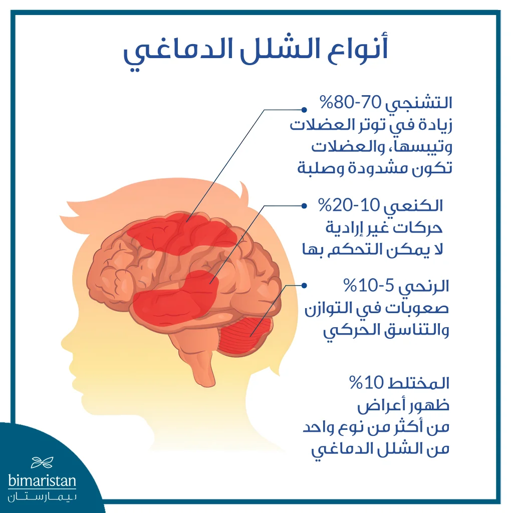 إعادة تأهيل الشلل الدماغي: خطوات لتحسين الحركة والنطق وجودة الحياة 3 صورة توضح أنواع الشلل الدماغي ونسبة انتشارها وما يميز كل حالة منها