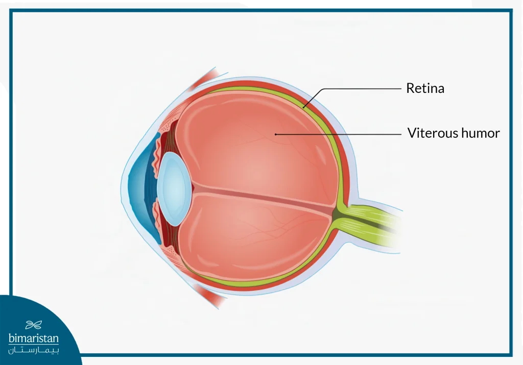 Vitrectomy In Türkiye: Procedure, Risks, And What Patients Need To Know 2025 3 An Image Showing The Position Of The Vitreous Humor In The Eye