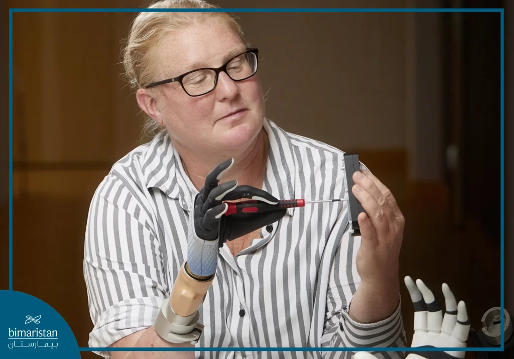 Electronic Prosthetic Limbs: Revolutionizing Motion And Muscle Control 4 The Ability Of Electronic Prosthetic Limbs To Grasp Accurately