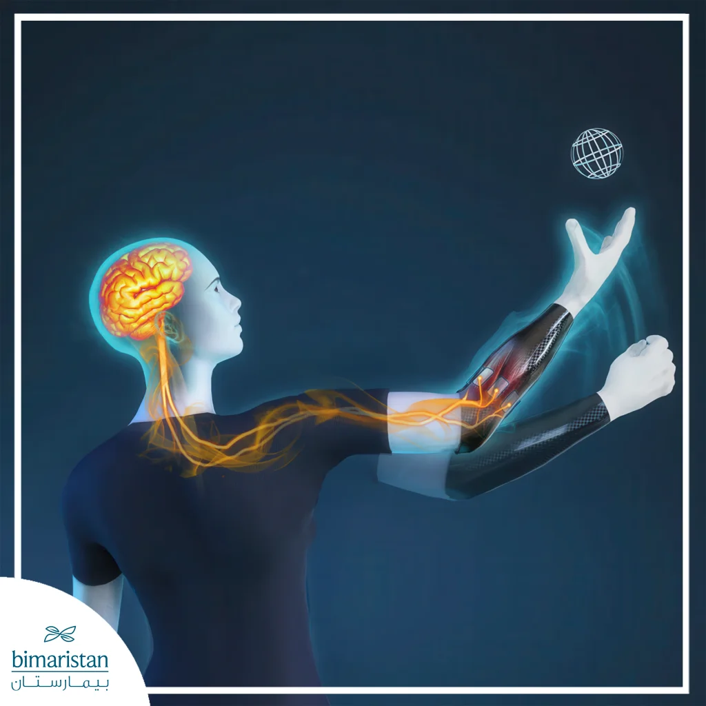 Electronic Prosthetic Limbs: Revolutionizing Motion And Muscle Control 3 How Electronic Prosthetic Limbs Convert Nerve Signals Into Motion By Detecting Neural Impulses And Translating Them Into Precise Movements