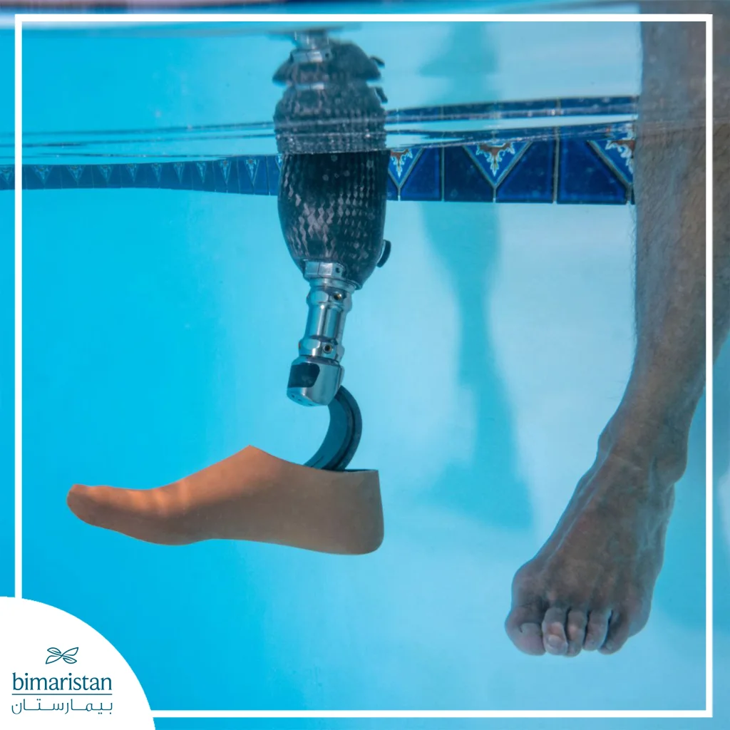Water-Resistant Lower Limb Prosthetics: Unmatched Freedom In Every Environment 2 An Image Showing The Shape Of Water-Resistant Lower Limb Prosthetics And How They Are Designed For Swimming