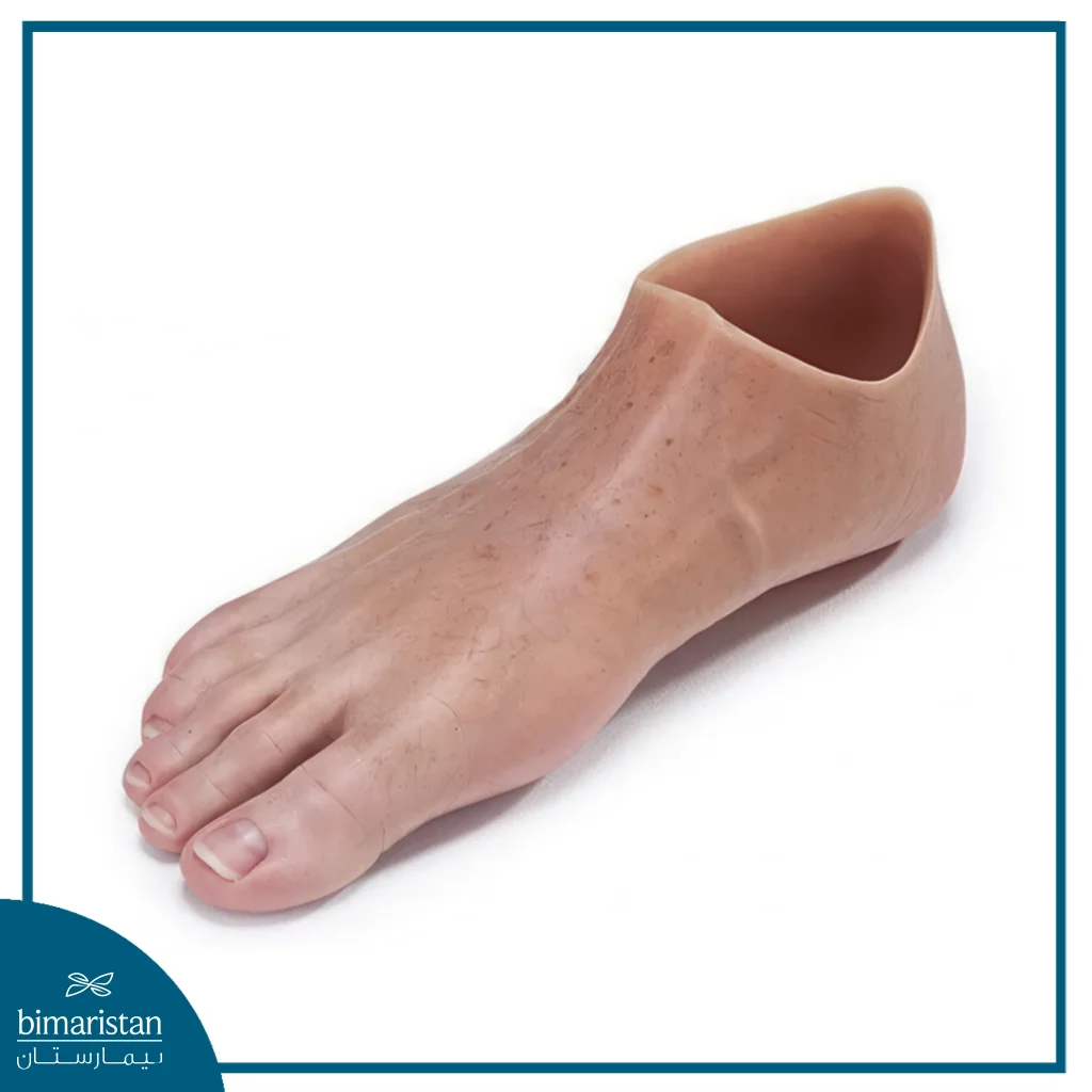 Silicone Prosthetics: The Future Of Aesthetic And Functional Restoration 1 An Image Showing A Silicone Prosthetic Limb