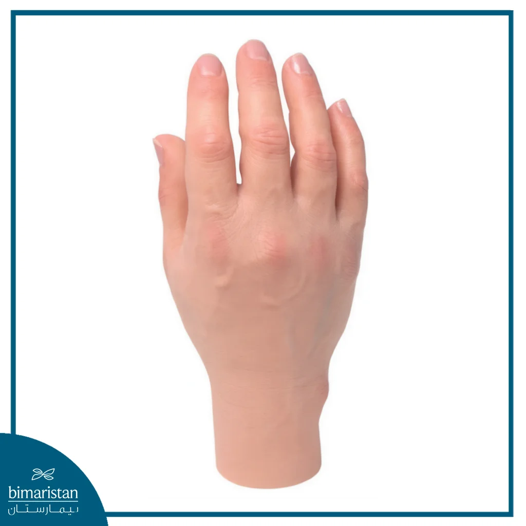 Silicone Prosthetics: The Future Of Aesthetic And Functional Restoration 2 An Image Showing The Shape Of A Silicone Prosthetic Hand