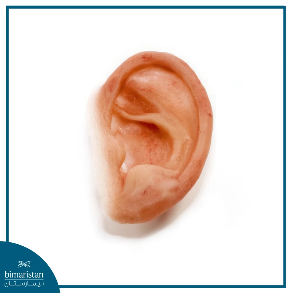 صور توضح شكل الأذن السليكونية