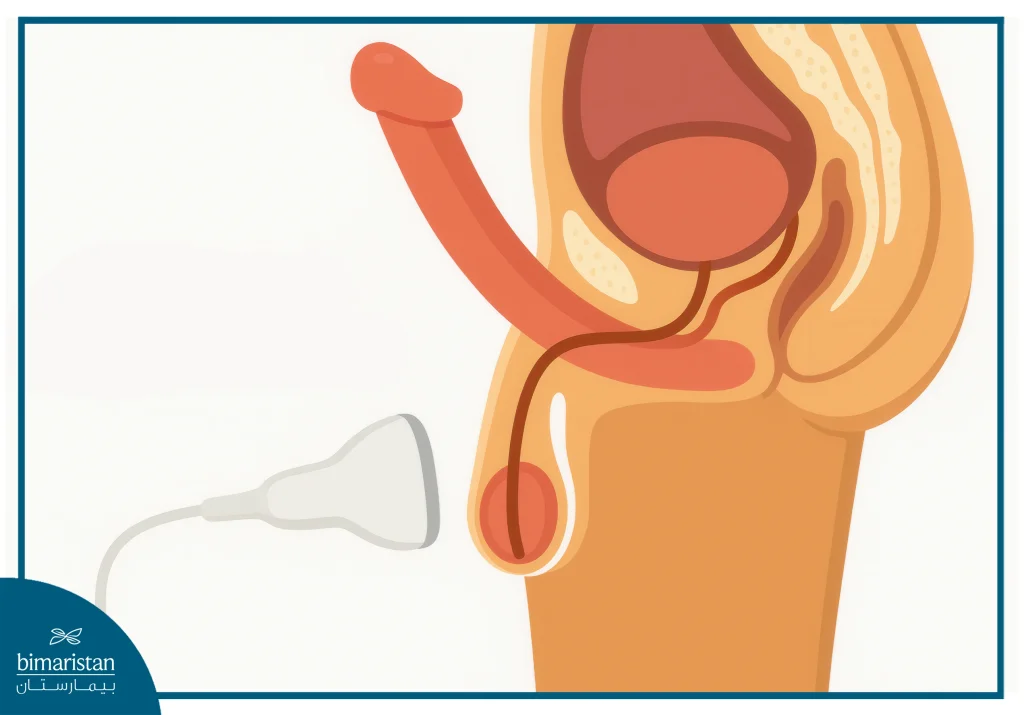 العقم: أنواعه وأسبابه وأهم علاجاته 3 الموجات فوق الصوتية للصفن