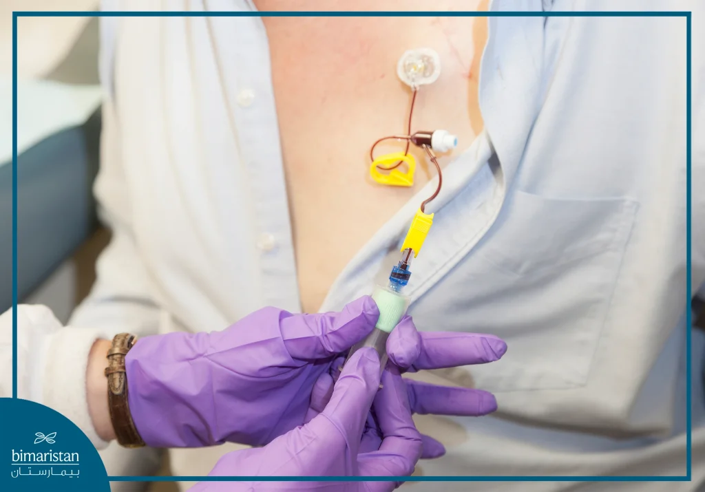 Chemotherapy Treatment In Turkey: Medical Procedures And Options 3 Illustration Of Chemotherapy Treatment In Turkey Via Port-A-Cath Dose Delivery In A Hospital Setting.