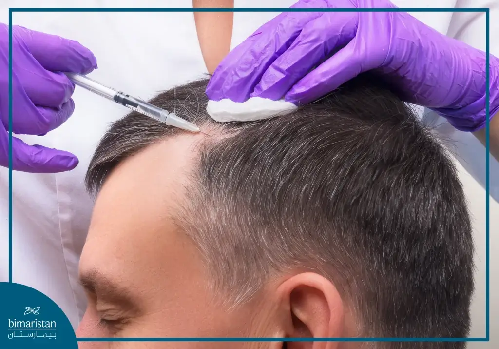 حقن البلازما للشعر بعد الزراعة في تركيا 2 صورة تبين كيفية حقن البلازما للشعر بعد الزراعة