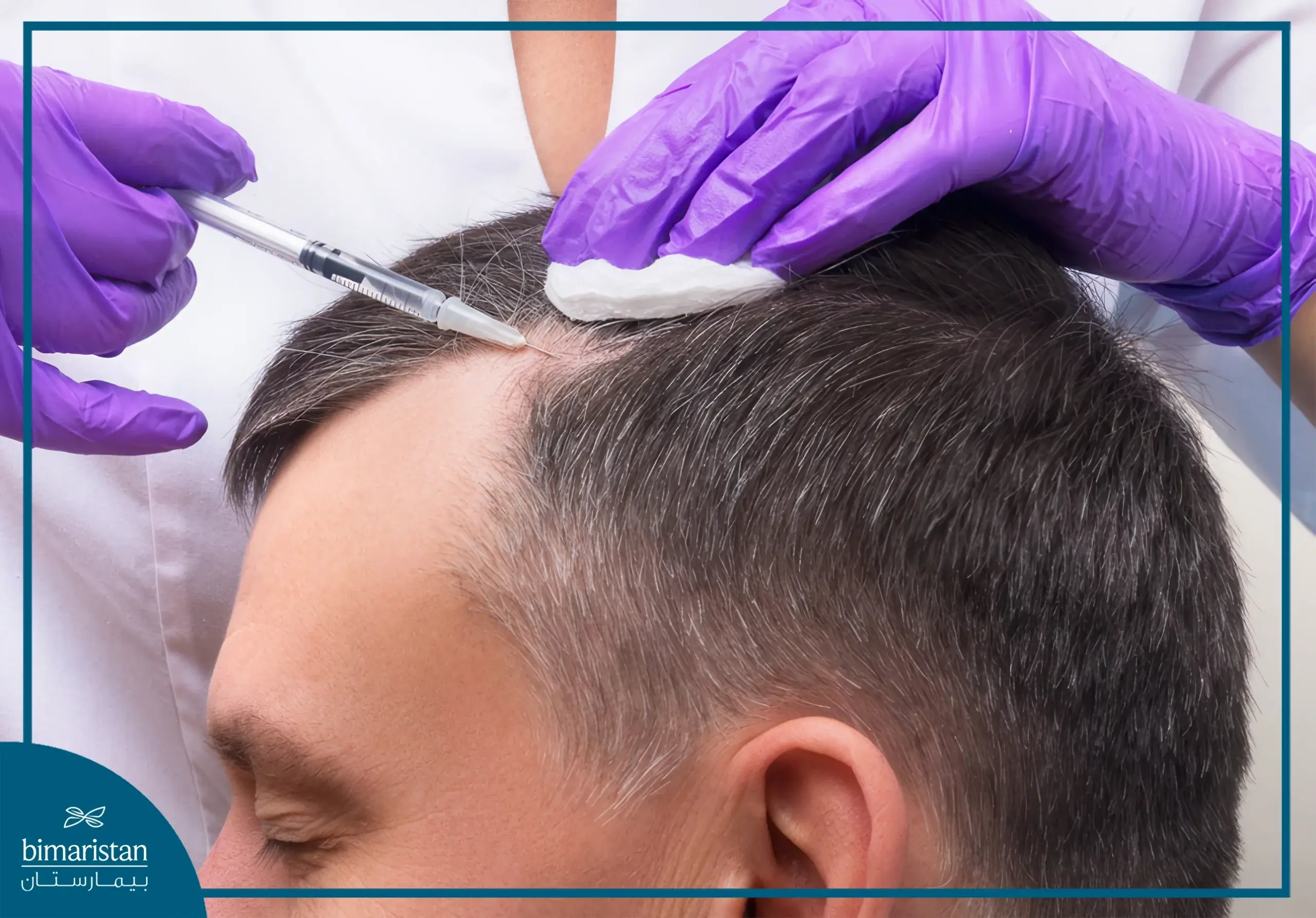 Plasma Injection For Hair After Transplantation In Turkey 2 A Photo Showing How Prp Is Administered To The Scalp Following A Hair Transplant Procedure.