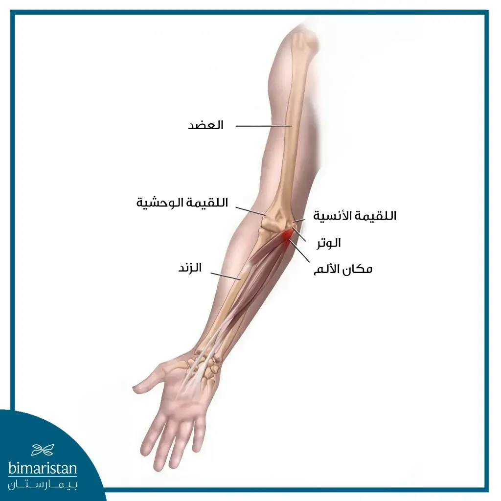 مرفق لاعب الغولف: أعراضه وطرق علاجه في تركيا 6 صورة تُظهر التركيب التشريحي للذراع والمساحة التي يشغلها الالتهاب.