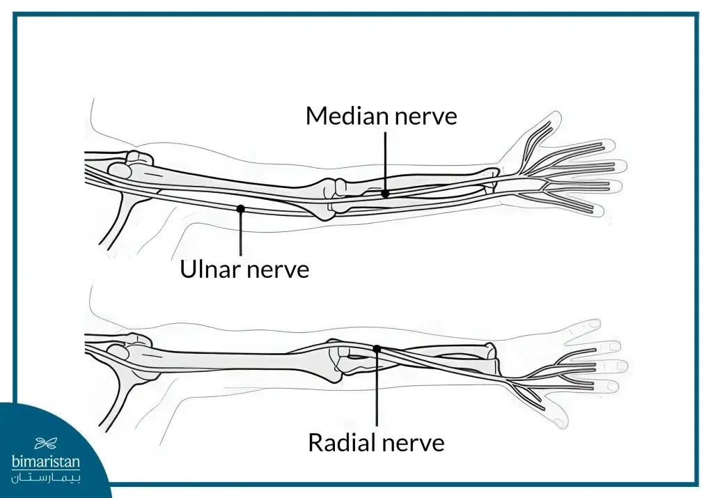 The Image Illustrates Anatomical Changes In The Locations Of The Nerves.