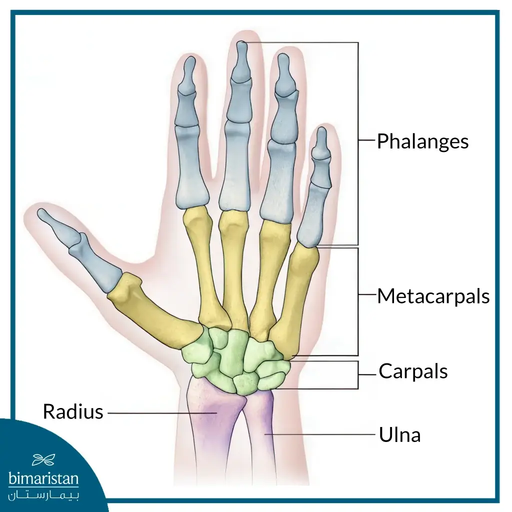 Finger Fractures: Clinical Assessment And Treatment Options 5 The Image Illustrates The Anatomical Positioning Of The Hand Bones.
