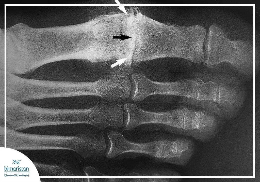 An X-Ray Image Of The Foot Region.
