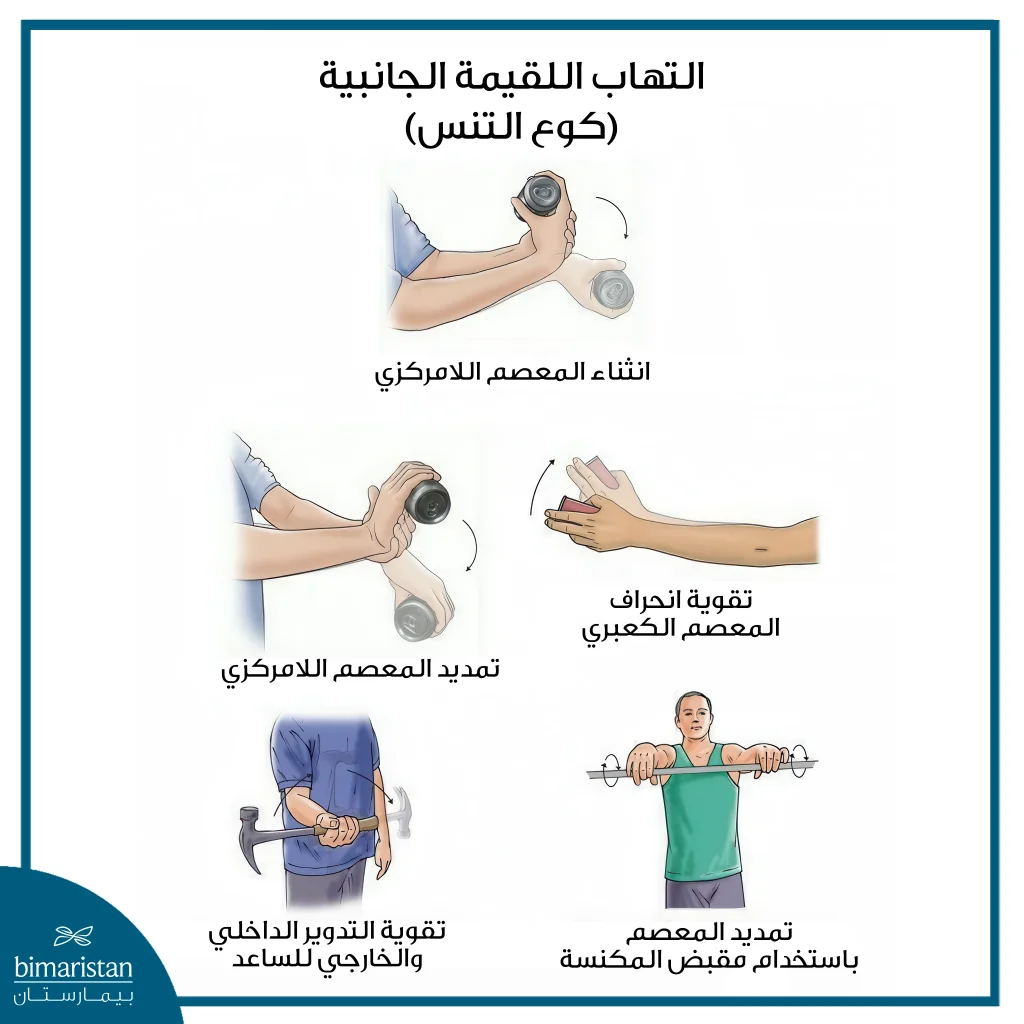 أهم طرق علاج مرفق التنس، الأسباب والأعراض 11 الصورة تُظهر مجموعة من الحركات العلاجية التي قد تُساهم في تخفيف أعراض التهاب مفصل التنس وتحسين وظيفة المفصل.