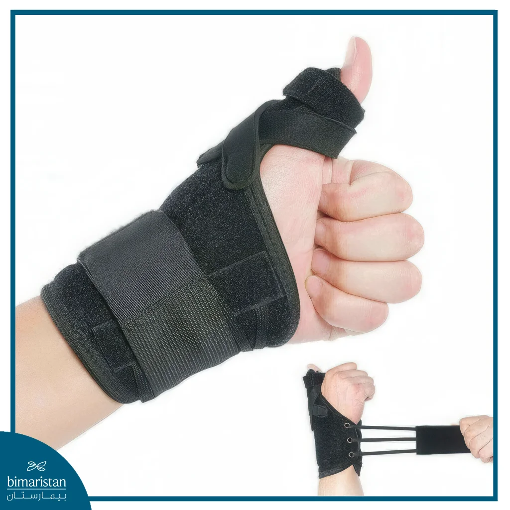 The Image Shows A Specialized Brace Designed To Immobilize The Thumb And Wrist, Commonly Used In Cases Of Tendon Inflammation Such As De Quervain’s Tenosynovitis.