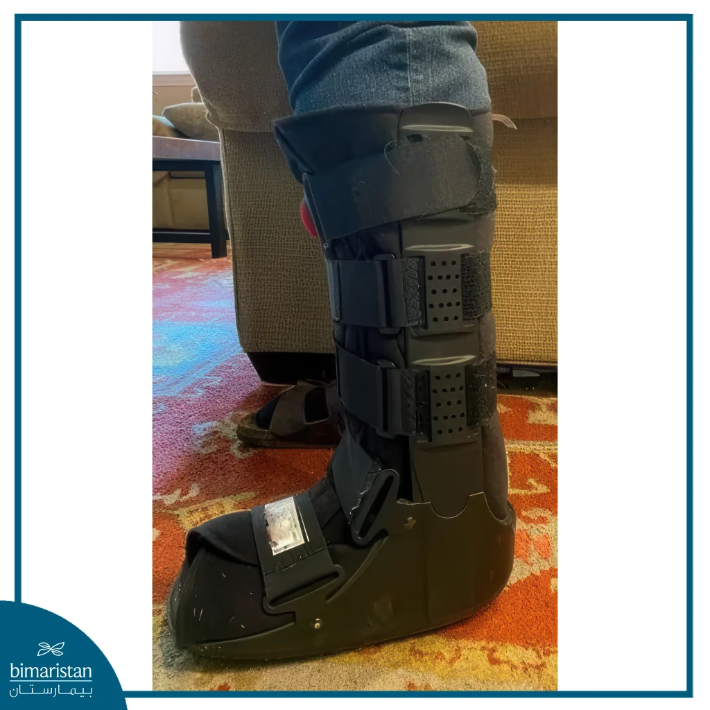 The Image Shows A Splint Used In Cases Of Metatarsal Fractures.