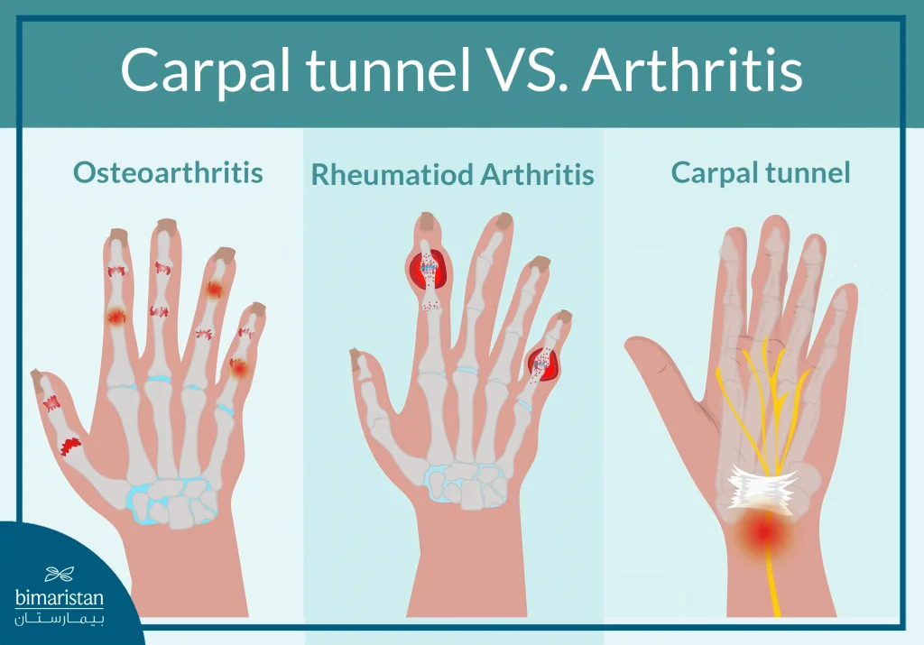The Image Illustrates Various Types Of Joint Inflammations Affecting The Hand And Wrist.