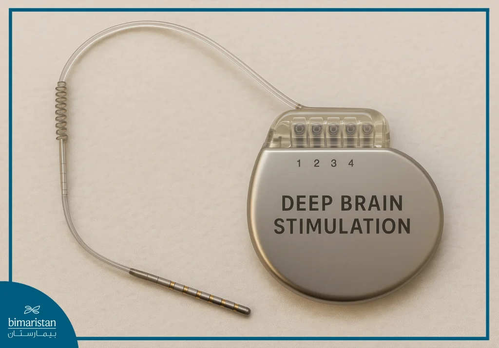Dbs Battery Replacement: When Parkinson’s Patients Need It And Why 5 Dbs Device: Delivers Precise Electrical Impulses Directly To The Brain