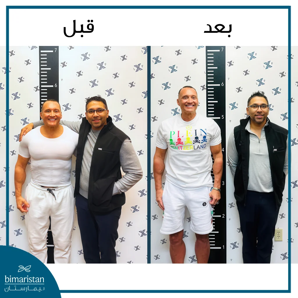 تطويل القامة بالمثبت الخارجي: نتائج واقعية وخطوات دقيقة 10 الفرق في الطول قبل وبعد عملية تطويل القامة بالمثبت الخارجي