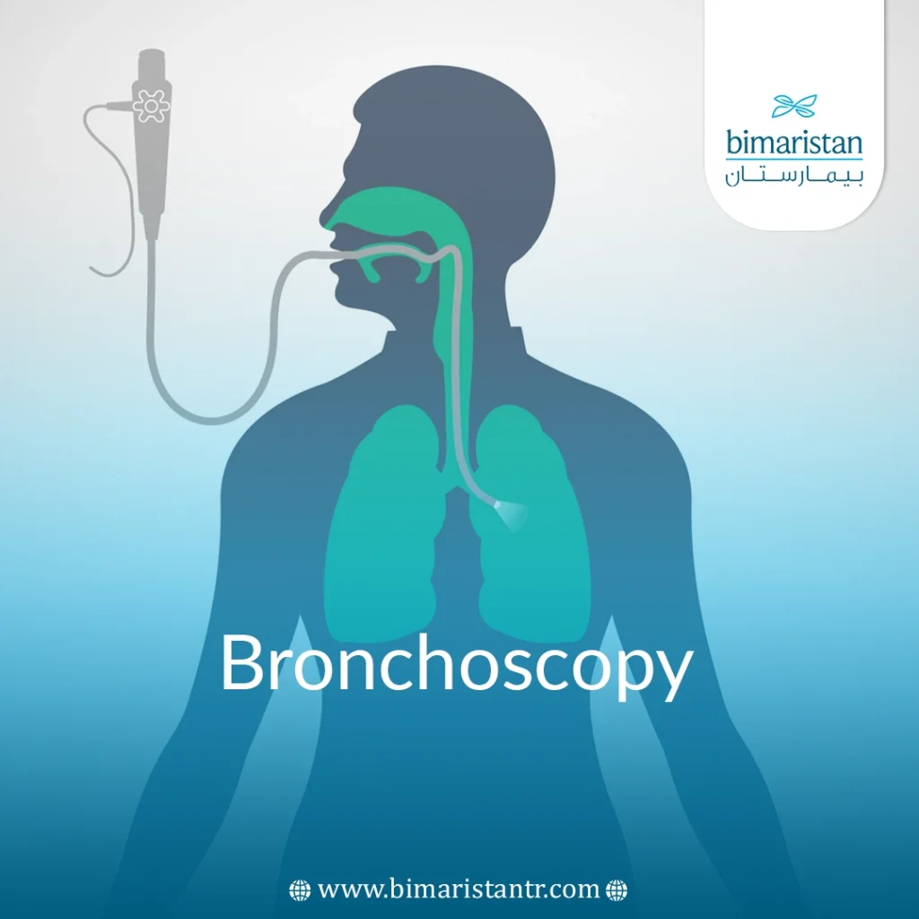 Bronchoscopy in Turkey: Procedure Steps & Recovery Guide