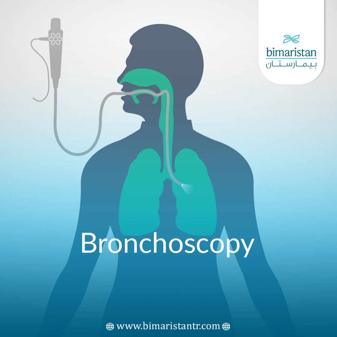 Bronchoscopy In Turkey: Procedure Steps &Amp;Amp; Recovery Guide