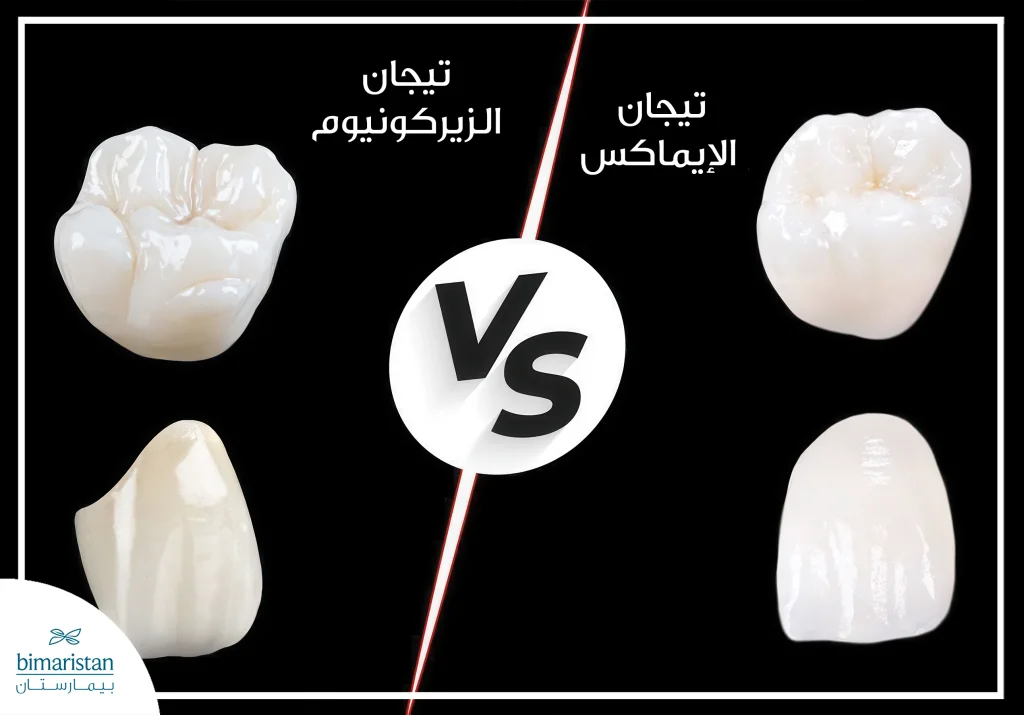 تيجان Efz: صلابة الزيركونيوم وجمالية الإيماكس في تركيبة واحدة مثالية 3 متانة وقوة الزيركونيوم مقارنة بشفافية ومظهر الإيماكس الطبيعي