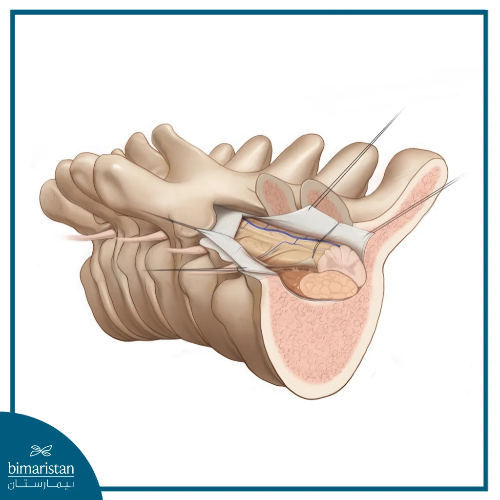 Meningioma Surgery: When It'S Needed And Chances Of Recovery 6 Spine Surgery To Remove A Meningioma
