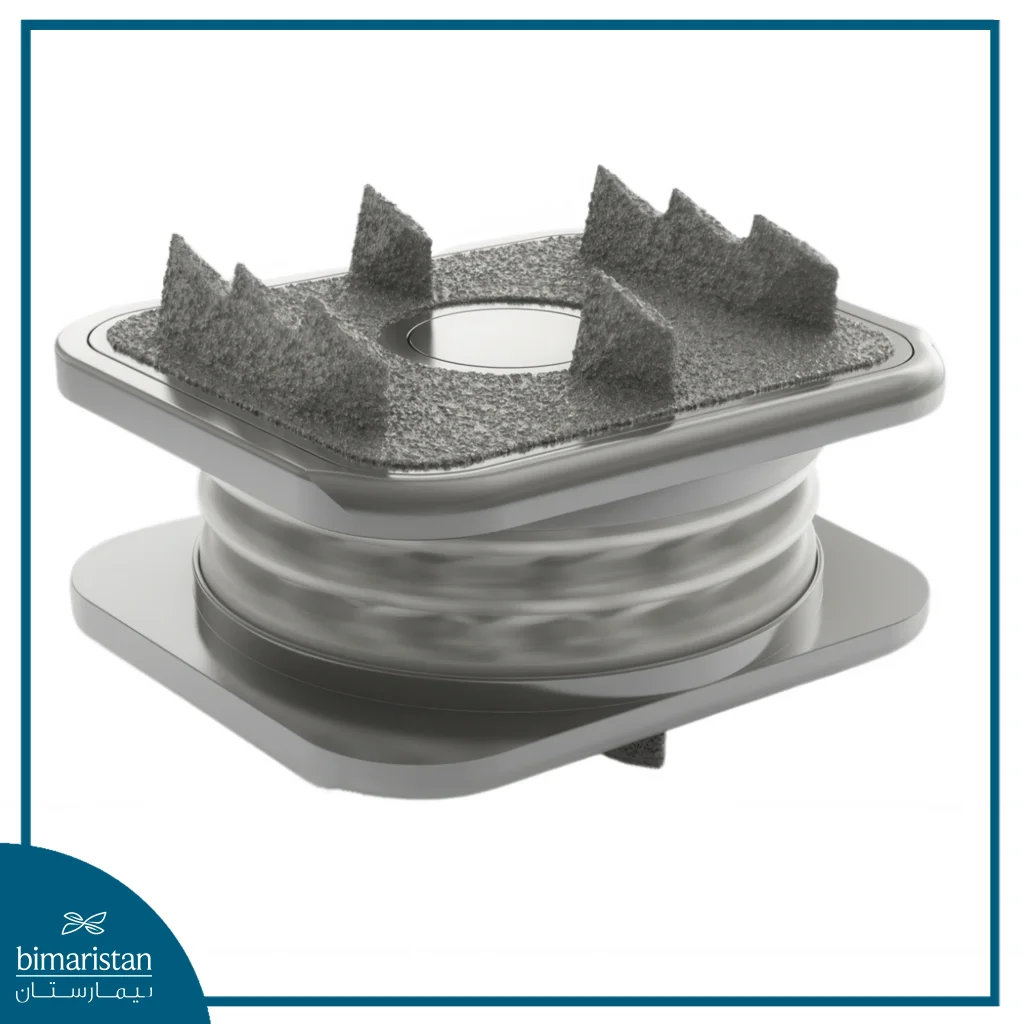 Artificial Disc Replacement: A Modern Alternative To Spinal Fusion For Herniated Discs 5 Innovative Design Mimics A Natural Disk With A Flexible Core And Synthetic Fibers