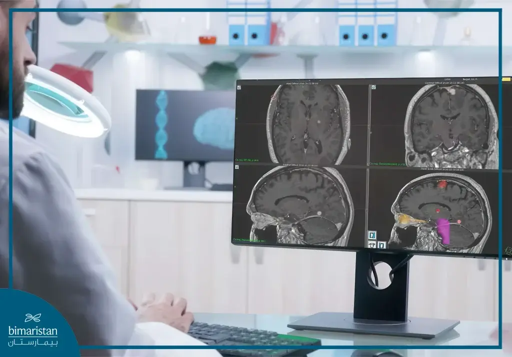 Gamma Knife Surgery 5 Gamma Knife Radiation Oncology Monitoring
