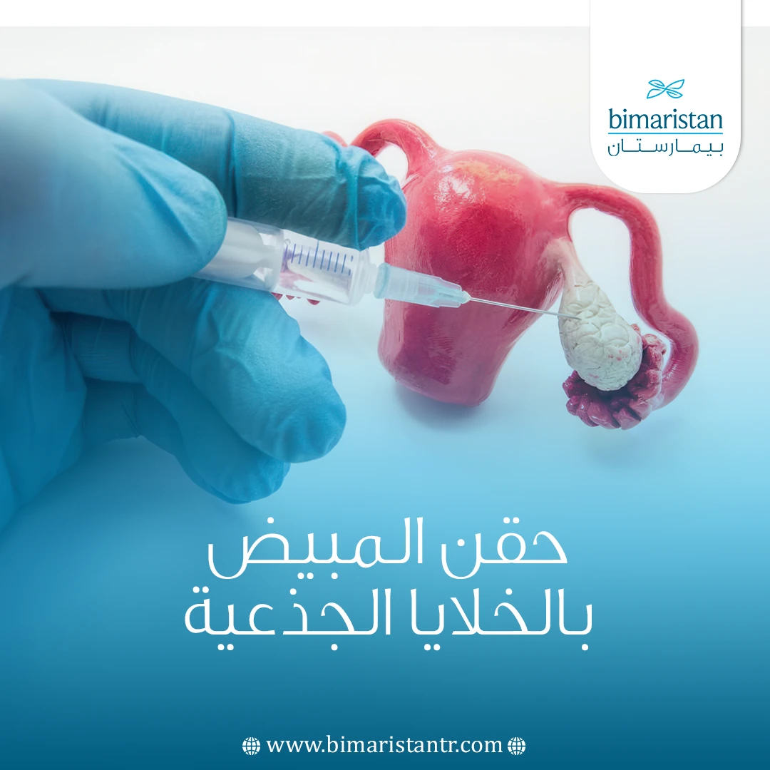 حقن المبيض بالخلايا الجذعية لعلاج العقم في تركيا